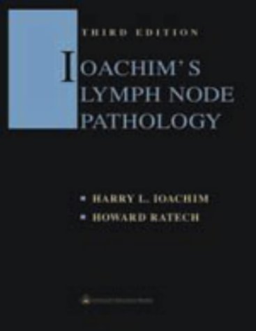 Lymphoma