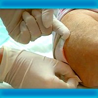 Wound Management / Staging Pressure DVD
