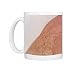 Freckled skin Photo Mugs