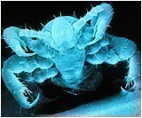 Parasites Eating Us Alive