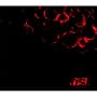 Blood (Digi pack with Bonus Disc Edition)