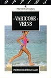 Varicose veins