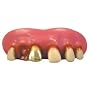 Billy-Bob Teeth Gold Miner