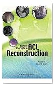 Current Concepts in ACL Reconstruction