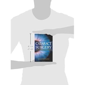 Cataract Surgery: A Patient's Guide to Cataract Treatment