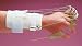 Rolyan Static Radial Nerve Splint Size: Small 7'8' (17.821.6cm) Uses static lines to support the wrist and extend the MCPs without strengthening the flexors or creating unwanted compensation patterns. As the finger flexor muscles contract, the wrist is extended , creating a tenodesis action of the wrist/hand. Adjusts easily for precise placement of the outrigger for a 90 line of pull. Includes thumb abduction components. Pre-formed from Polyform splinting material and lined with Kushionflex padding. For size, measure circumference of mid-forearm. Product photo may not exactly match the product offered for sale. Please refer to the product description.