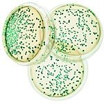 Transformation of E.Coli with pGAL