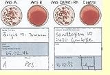 Blood Type Kit - Also Includes: 1 Eldoncard, 1 lancet, gauze, alcohol wipe, micropipette