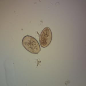 Fasciolopsis buski Microscope Slide