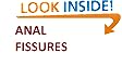 Anal Fissures: Treatment and Prevention