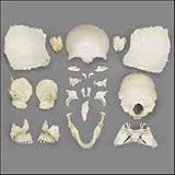 Disarticulated Female Skull Model in Storage Box