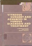 Vitreous surgery and advances in fundus diagnosis and treatment