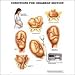 Conditions For Cesarean Section Anatomical Chart 20