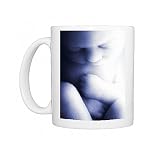Foetus around 9 months old Photo Mugs