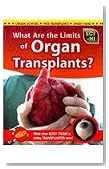 What Are the Limits of Organ Transplants? (Sci-Hi)