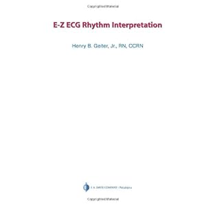 E-Z ECG Rhythm Interpretation