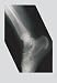 All Products : Ankle 12x18 Giclee on canvas - Prints - 11737-0CG12