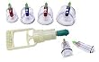 Biomagnetic Suction Cupping - 6 Cups