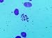 Triple X Syndrome X40 Photomicrograph Photographic Poster Print, 16x12
