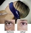 Eye Mask Under Eye Bag Blocker