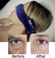 Eye Mask Under Eye Bag Blocker