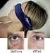 Eye Mask Under Eye Bag Blocker