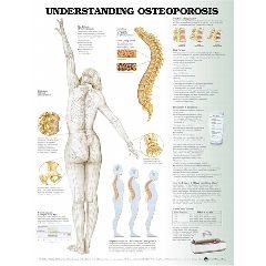 Buy Anatomical Chart – Osteoperosis
