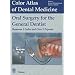 Oral Surgery for the General Dentist