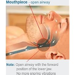 Stop Snoring Remedy Mouth Piece - Anti Snore Mouth Guard Device