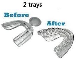 2 Teeth Tooth mouth Whitening Thermoform Fit Trays treys for Bleaching bleeching