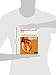 Cardiopulmonary Bypass (Cambridge Clinical Guides)