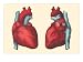 Anterior and Posterior Views of the Heart Giclee Poster Print, 24x18