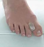 Toe Separators- Bunion Ease (2 pieces) by tallerheels