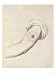 Cowpox Pustule on an Arm, 1800 Giclee Poster Print by William Skelton, 18x24
