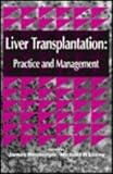 Liver transplantation : practice and management