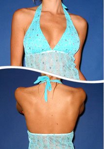 Barbados Halter Tankini Top