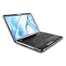 Toshiba Satellite P305d-s8834 17-inch Laptop (2.0 Ghz Amd Turion X2 Rm-70 Processor, 4 Gb Ram, 250 Gb Hard Drive, Dvd Drive, Vista Premium) Black