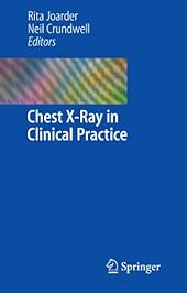 Chest X-Ray in Clinical Practice-Wow! eBook