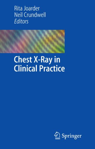 Chest X-Ray in Clinical Practice Chest X-Ray in Clinical Practice
