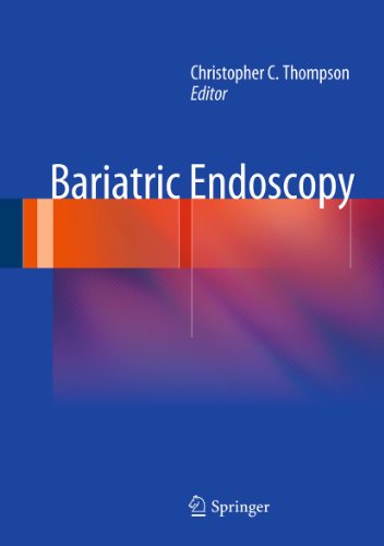 Bariatric Endoscopy On Sale