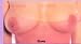 Breasts