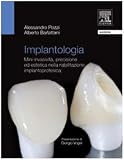 Implantologia estetica. Mini-invasività, precisione ed estetica nella riabilitazione