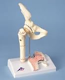 Femoral Fracture and Hip Osteoarthritis Model
