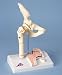 Femoral Fracture and Hip Osteoarthritis Model