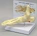 Ankle & Foot Model with Plantar Fasciitis - with plantar fasciitis