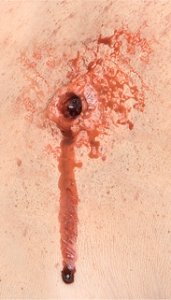 Bullet Entry Prosthetic Makeup Accessory