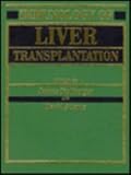 Immunology of liver transplantation