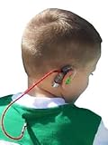 Middle Ear Implant Implantable Hearing AIDS Advances in Audiology