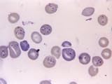 Photomic Babesia Microti and Plasmodium Berghei Photographic Poster Print, 24x18