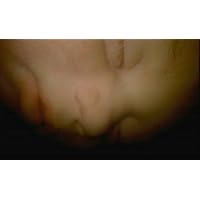 In the Womb